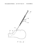 METHOD AND APPARATUS FOR DELIVERY INTO THE FETAL TRACHEA diagram and image