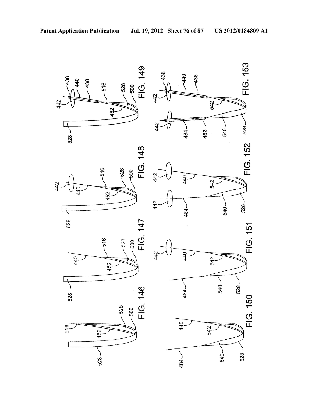 DEVICES AND METHODS FOR TISSUE MODIFICATION - diagram, schematic, and image 77