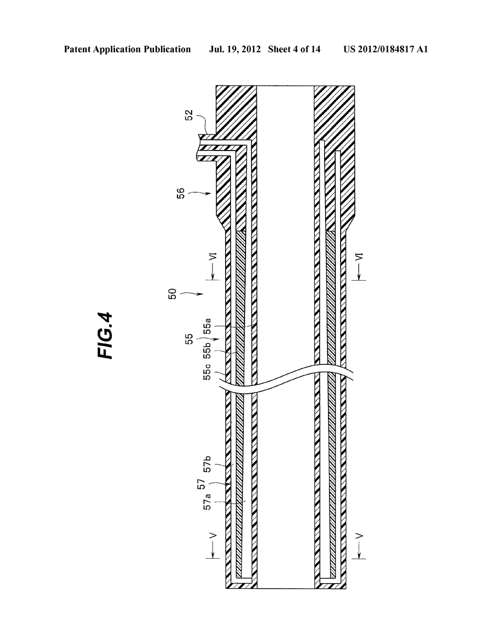 INSERTION AID AND ENDOSCOPE APPARATUS - diagram, schematic, and image 05