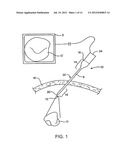 ENDOSCOPE diagram and image