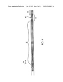 ENDOSCOPE diagram and image