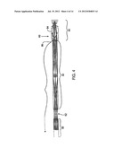 ENDOSCOPE diagram and image