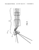 ENDOSCOPE diagram and image