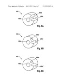 Implantable Electrode Lead diagram and image