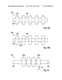 Implantable Electrode Lead diagram and image