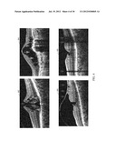 AUTOMATED MACULAR PATHOLOGY DIAGNOSIS IN THREEDIMENSIONAL (3D) SPECTRAL     DOMAIN OPTICAL COHERENCE TOMOGRAPHY (SD-OCT) IMAGES diagram and image