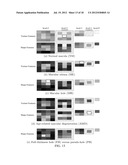 AUTOMATED MACULAR PATHOLOGY DIAGNOSIS IN THREEDIMENSIONAL (3D) SPECTRAL     DOMAIN OPTICAL COHERENCE TOMOGRAPHY (SD-OCT) IMAGES diagram and image