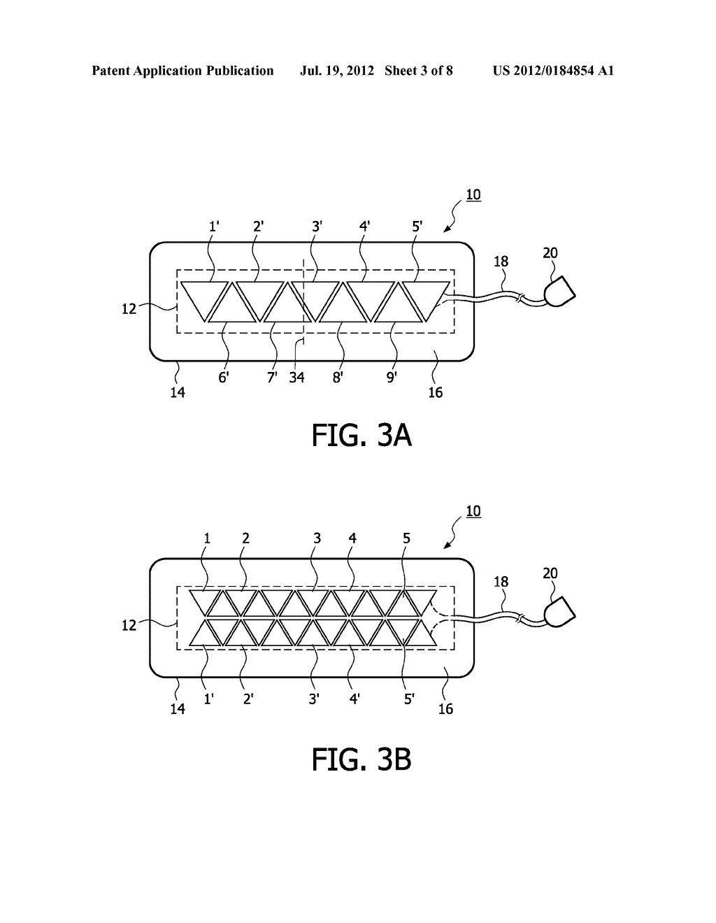 ULTRASONIC VASCULAR FLOW SENSOR WITH TRIANGULAR SENSOR GEOMETRY - diagram, schematic, and image 04