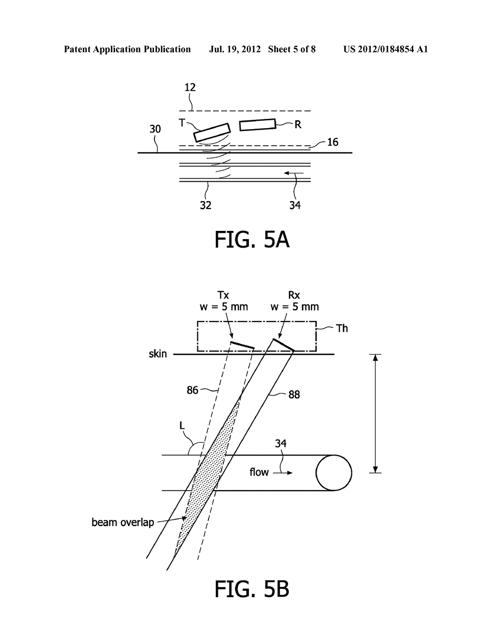 ULTRASONIC VASCULAR FLOW SENSOR WITH TRIANGULAR SENSOR GEOMETRY - diagram, schematic, and image 06