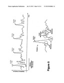 Diagnostic Classifications of Pulse Signal Waveform Data diagram and image