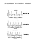 Diagnostic Classifications of Pulse Signal Waveform Data diagram and image