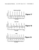 Diagnostic Classifications of Pulse Signal Waveform Data diagram and image