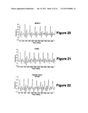 Diagnostic Classifications of Pulse Signal Waveform Data diagram and image