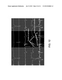 ELECTROANATOMICAL MAPPING diagram and image