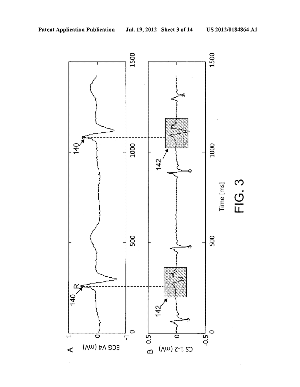 ELECTROANATOMICAL MAPPING - diagram, schematic, and image 04