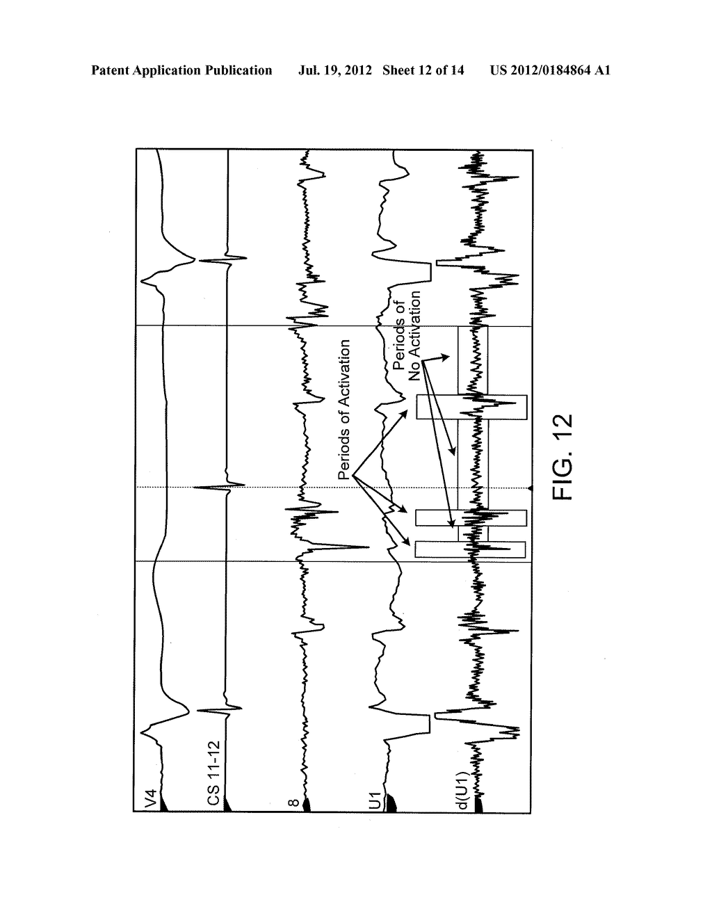 ELECTROANATOMICAL MAPPING - diagram, schematic, and image 13