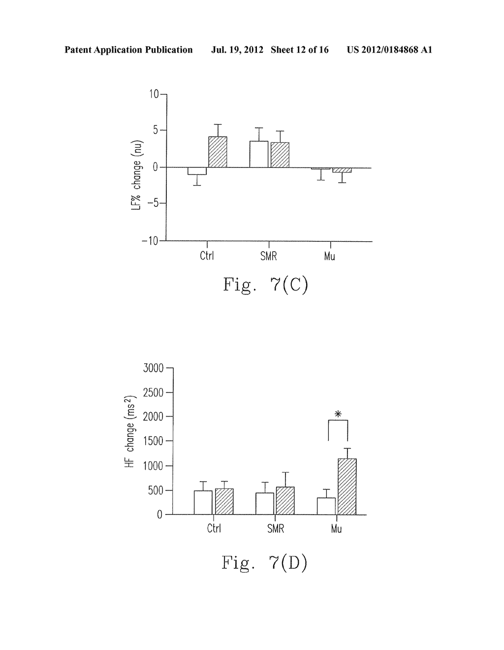 APPARATUS AND METHOD OF ENHANCING MEMORY ABILITY AND PARASYMPATHETIC     ACTIVITY - diagram, schematic, and image 13