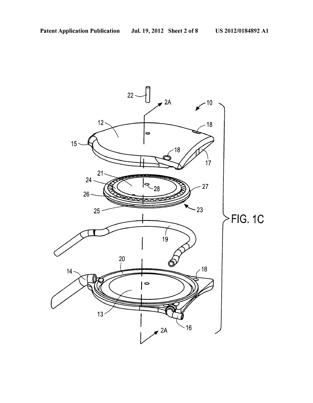 APPARATUS AND METHODS FOR TREATING EXCESS INTRAOCULAR FLUID - diagram, schematic, and image 03