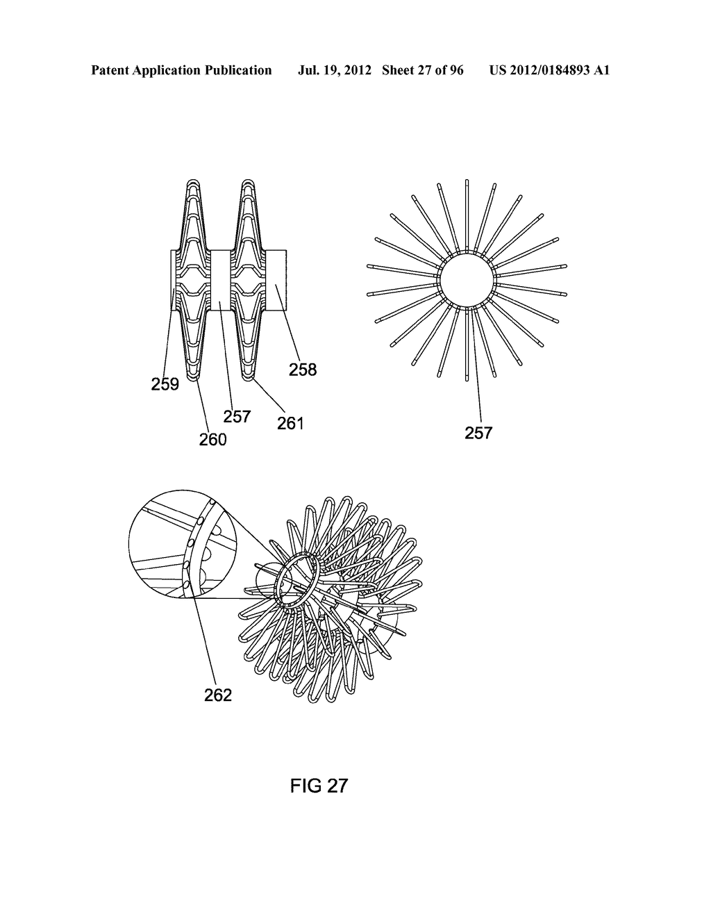 ANCHORS AND METHODS FOR INTESTINAL BYPASS SLEEVES - diagram, schematic, and image 28