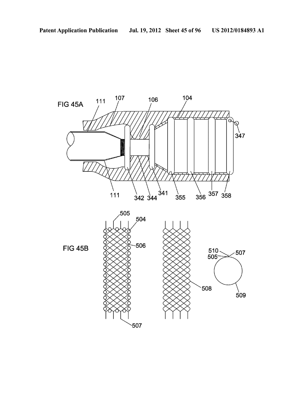 ANCHORS AND METHODS FOR INTESTINAL BYPASS SLEEVES - diagram, schematic, and image 46