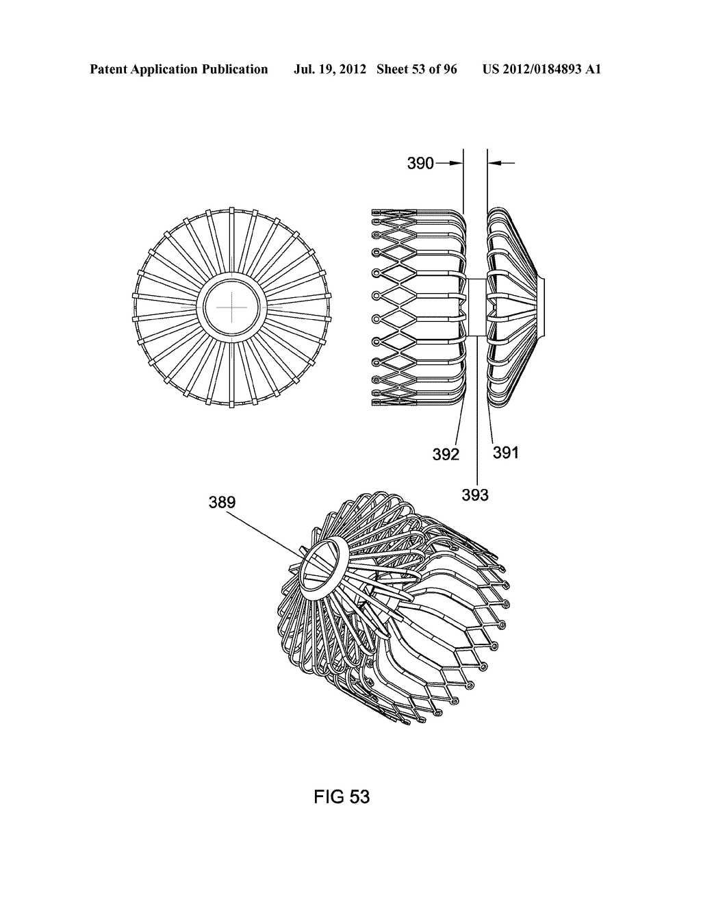 ANCHORS AND METHODS FOR INTESTINAL BYPASS SLEEVES - diagram, schematic, and image 54