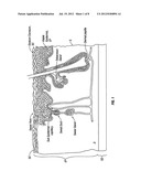 Patches and Methods for the Transdermal Delivery of Agents to Treat Hair     Loss diagram and image