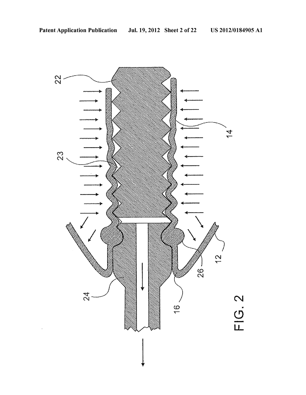 SLOW RELEASE LIQUID DRUG DELIVERY DEVICE - diagram, schematic, and image 03