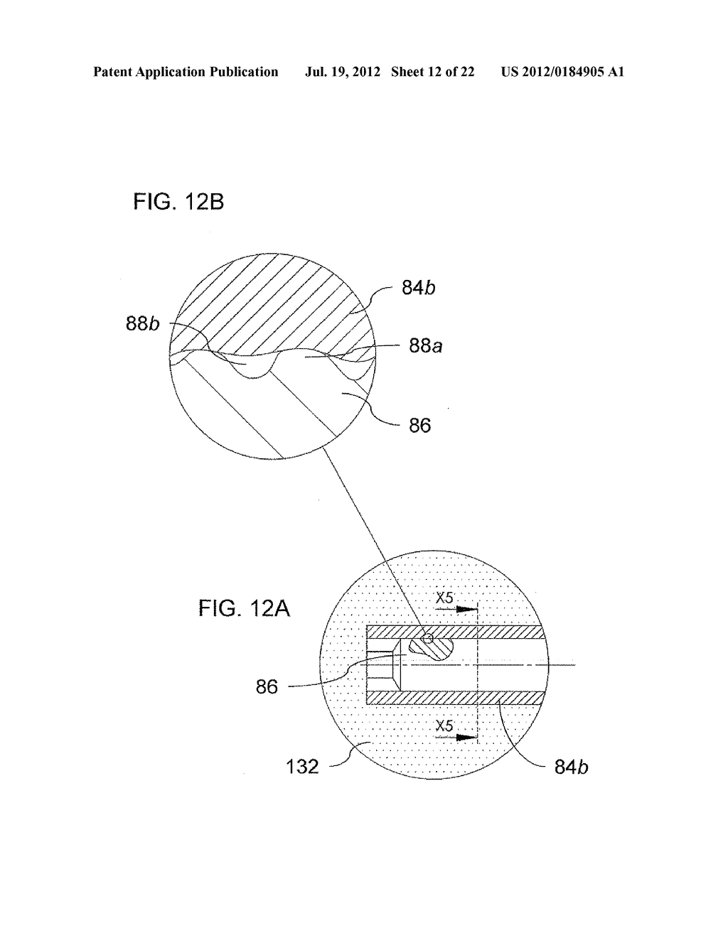 SLOW RELEASE LIQUID DRUG DELIVERY DEVICE - diagram, schematic, and image 13