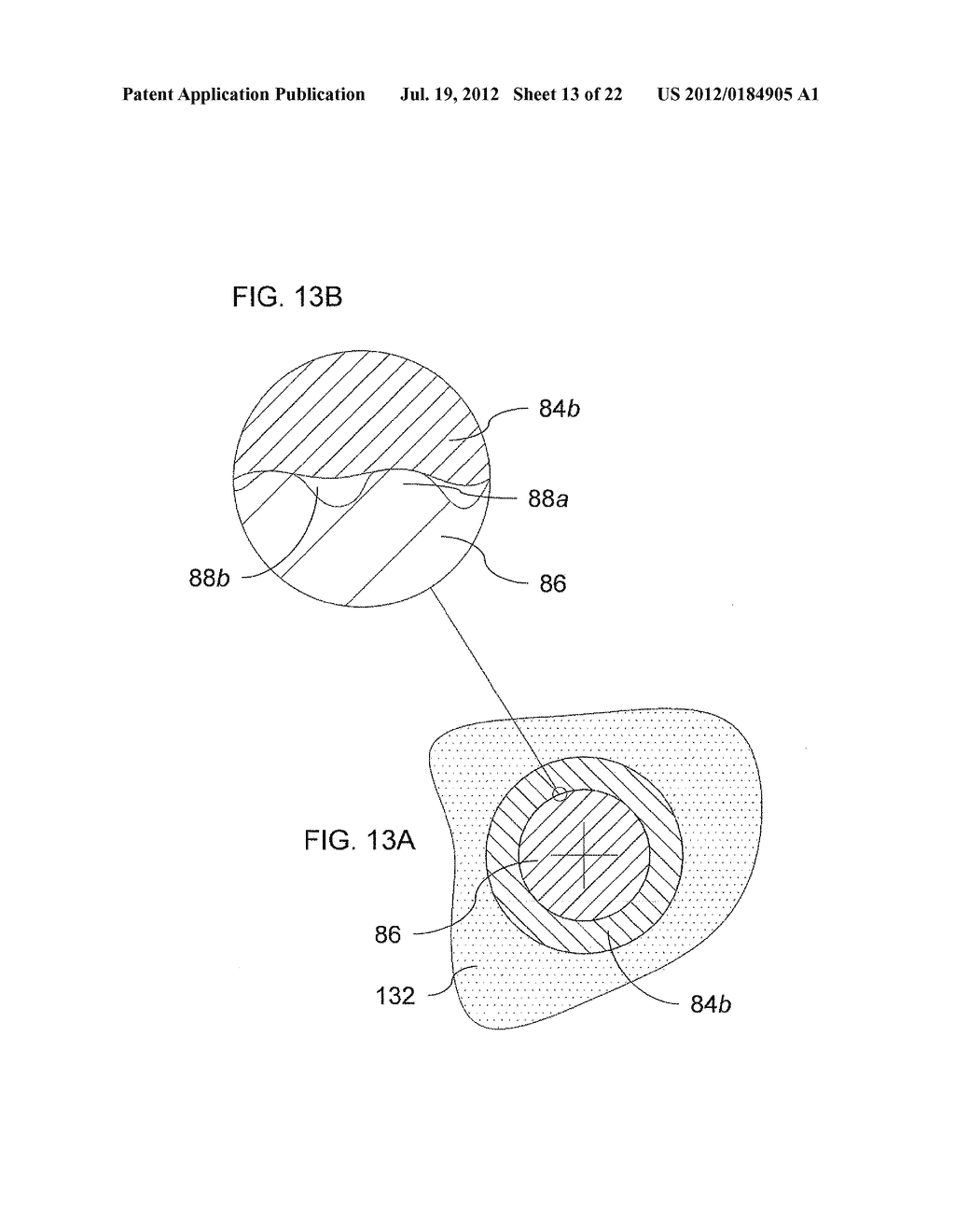 SLOW RELEASE LIQUID DRUG DELIVERY DEVICE - diagram, schematic, and image 14