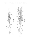 CATHETER INSERTION DEVICE diagram and image