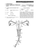 ASSEMBLY AND KIT FOR MARKING TUBAL OSTIA diagram and image