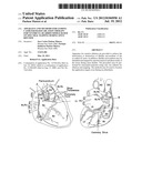 Apparatus and Methods for Guiding Catheter-Based Ablation Therapy for     Ventricular Arrhythmias Based on Spectral Mapping During Sinus Rhythm diagram and image