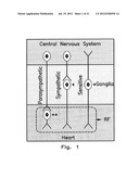 Apparatus and Methods for Guiding Catheter-Based Ablation Therapy for     Ventricular Arrhythmias Based on Spectral Mapping During Sinus Rhythm diagram and image