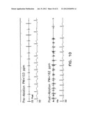 Apparatus and Methods for Guiding Catheter-Based Ablation Therapy for     Ventricular Arrhythmias Based on Spectral Mapping During Sinus Rhythm diagram and image