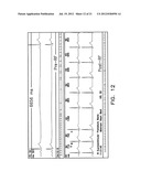 Apparatus and Methods for Guiding Catheter-Based Ablation Therapy for     Ventricular Arrhythmias Based on Spectral Mapping During Sinus Rhythm diagram and image