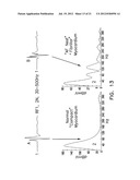 Apparatus and Methods for Guiding Catheter-Based Ablation Therapy for     Ventricular Arrhythmias Based on Spectral Mapping During Sinus Rhythm diagram and image