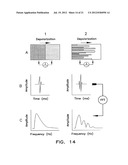 Apparatus and Methods for Guiding Catheter-Based Ablation Therapy for     Ventricular Arrhythmias Based on Spectral Mapping During Sinus Rhythm diagram and image