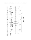 Apparatus and Methods for Guiding Catheter-Based Ablation Therapy for     Ventricular Arrhythmias Based on Spectral Mapping During Sinus Rhythm diagram and image