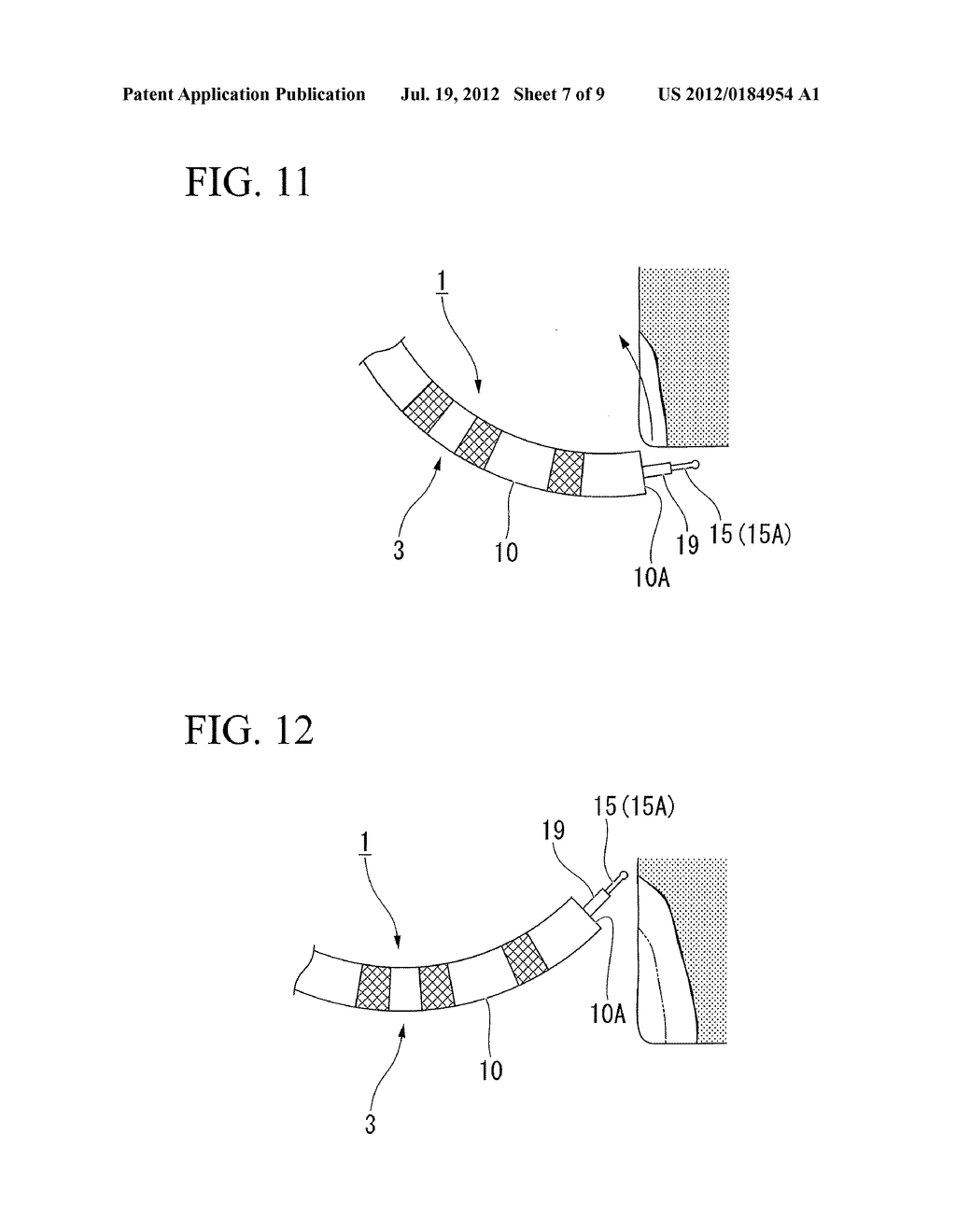 ENDOSCOPIC TREATMENT INSTRUMENT AND TISSUE INCISION METHOD - diagram, schematic, and image 08