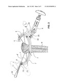 BOLT AND TOOL WITH ANTI-TORQUE FEATURES diagram and image