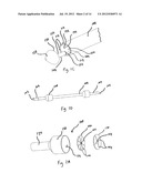 EXCHANGEABLE SYSTEM FOR MINIMALLY INVASIVE BEATING HEART REPAIR OF HEART     VALVE LEAFLETS diagram and image