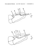 EXCHANGEABLE SYSTEM FOR MINIMALLY INVASIVE BEATING HEART REPAIR OF HEART     VALVE LEAFLETS diagram and image