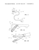 ENDOSCOPIC TISSUE ANCHOR DEPLOYMENT diagram and image