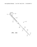 ENDOSCOPIC TISSUE ANCHOR DEPLOYMENT diagram and image