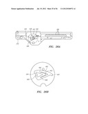 ENDOSCOPIC TISSUE ANCHOR DEPLOYMENT diagram and image