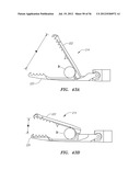 ENDOSCOPIC TISSUE ANCHOR DEPLOYMENT diagram and image