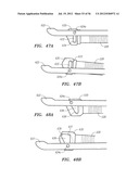 ENDOSCOPIC TISSUE ANCHOR DEPLOYMENT diagram and image