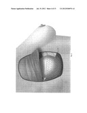 Supporting and Forming Transitional Material for Use in Supporting     Prosthesis Devices, Implants and to Provide Structure in a Human Body diagram and image