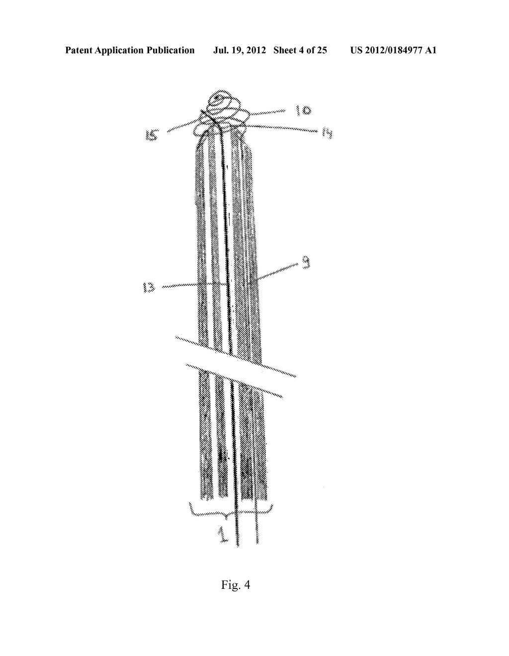 Device and Method for Crossing Occlusions - diagram, schematic, and image 05