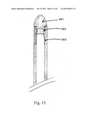 Device and Method for Crossing Occlusions diagram and image